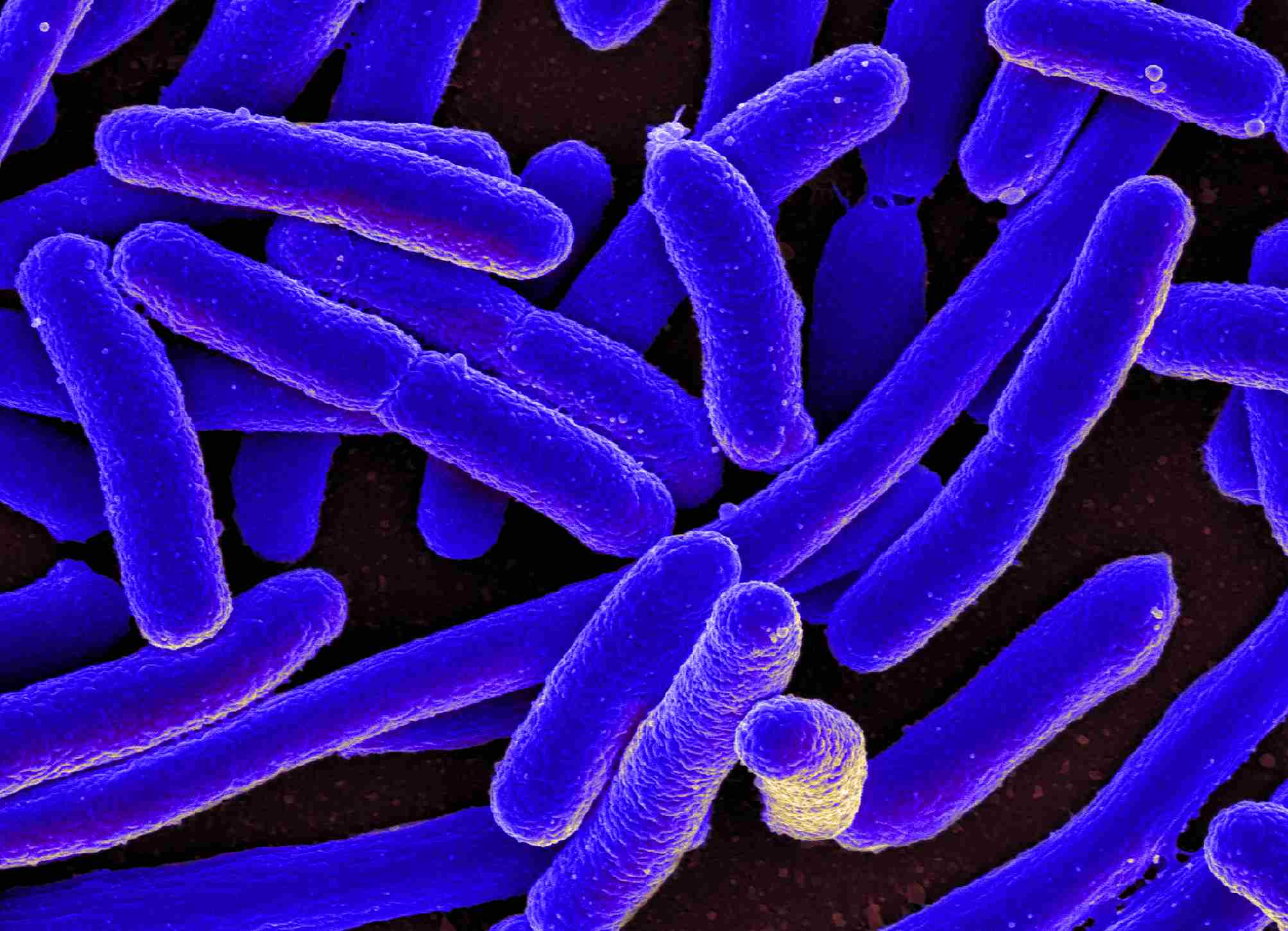 https://www.nepalminute.com/uploads/posts/E._coli_Bacteria_(16578744517)_11zon1681280198.jpg